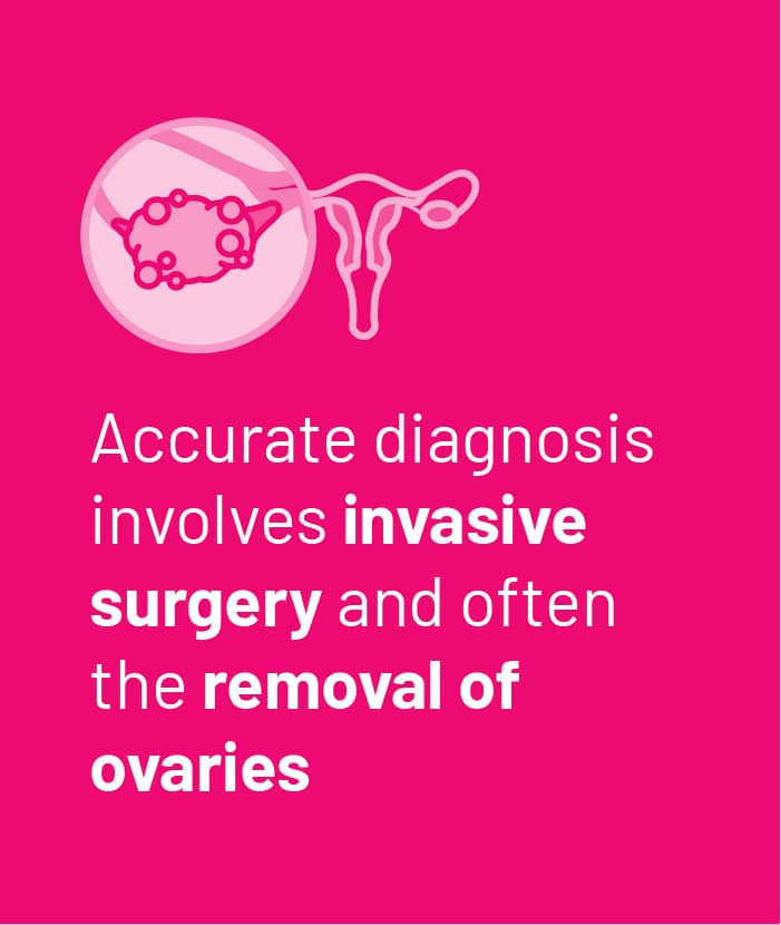 Accurate diagnosis involves invasive surgery and often the removal of ovaries